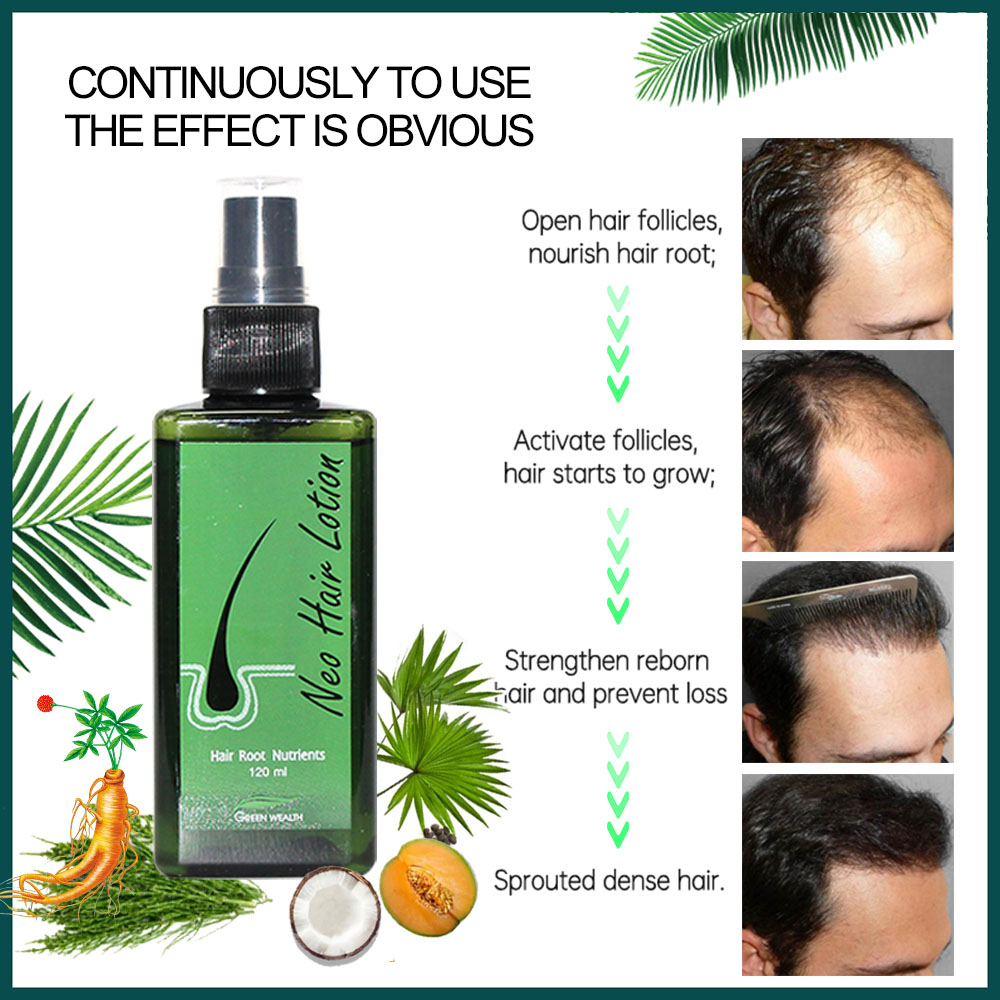 Loción para el cabello Neo Ori - Hair Care Thailand reseña y precio